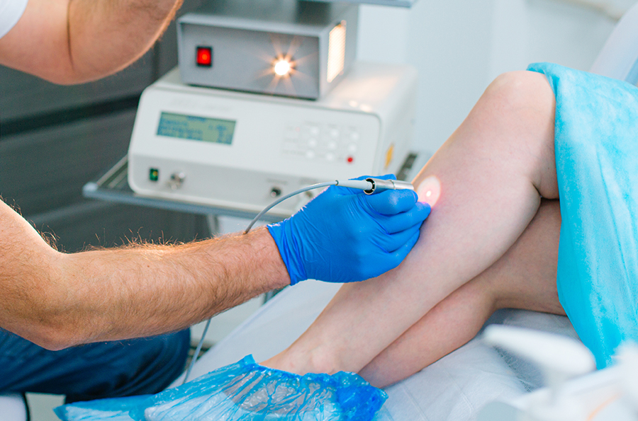 Laser vein removal at Precision Medical Center